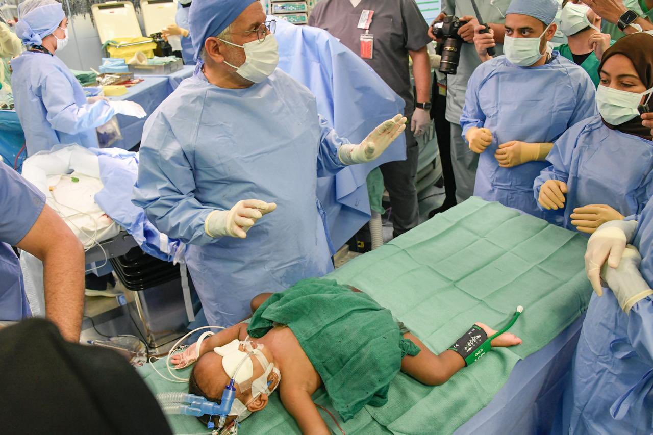 Saudi Arabian medical team has successfully carried out the separation surgery of Nigerian conjoined twins, Hassana and Husaina, at the King Abdullah Specialist Children’s Hospital