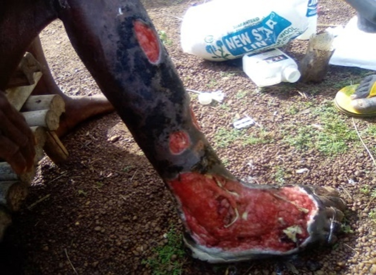 Buruli Ulcer : Creating family disharmony beyond the disease, By TERFA KENE 2 Kene 2