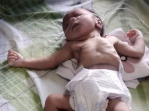 Abandoned baby