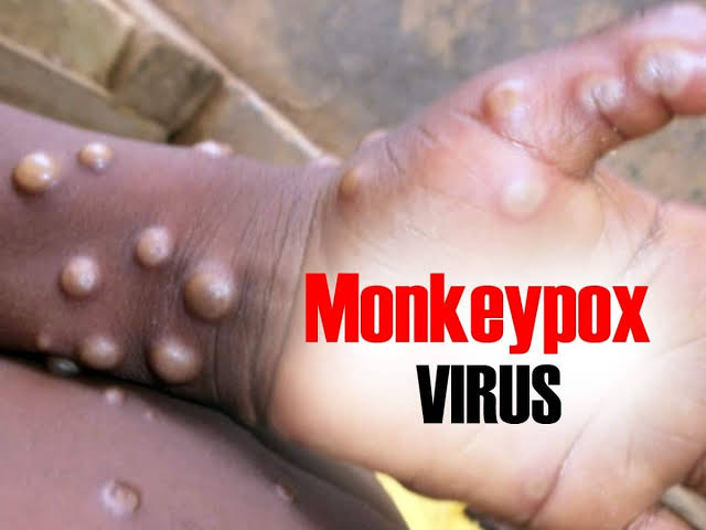 Money Pox MPOx