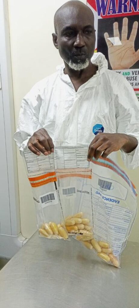 After 35 years in Brazil, businessman returns home with 29 wraps of ingested cocaine in his stomach 2 image 750x 674c329da2b65