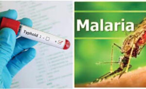 Diagnosing typhoid and malaria. Image source: STH and odoctorng