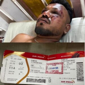 Ramesh Viswashkumar, the British man and sole survivor of an air crash that killed around 241 people today in Ahmedabad,