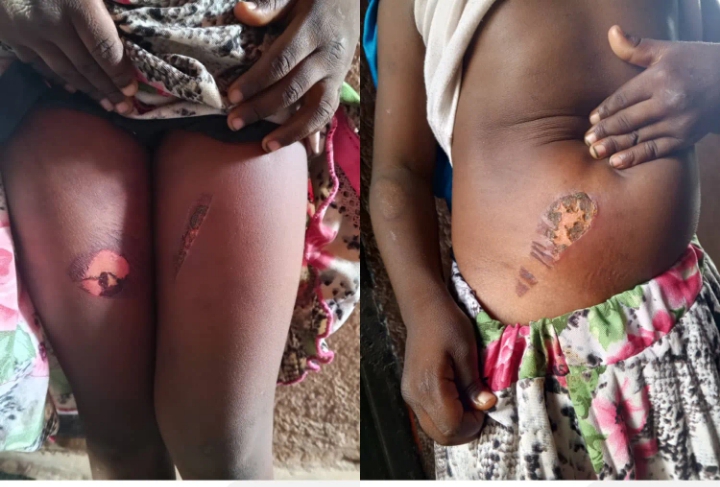 Bauchi police nab teacher for assaulting almajiri boy