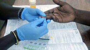 HIV test