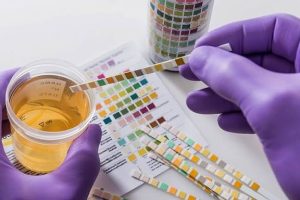 FG mandates drug test for public service jobs, partners NDLEA to curb substance abuse
