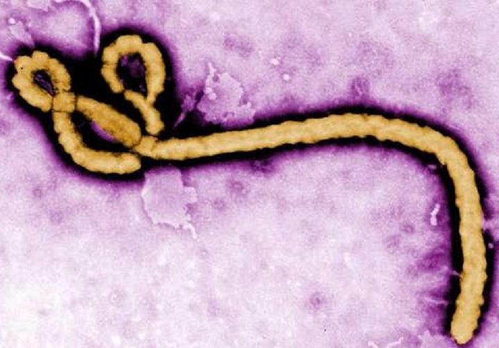 Ebola virus 1