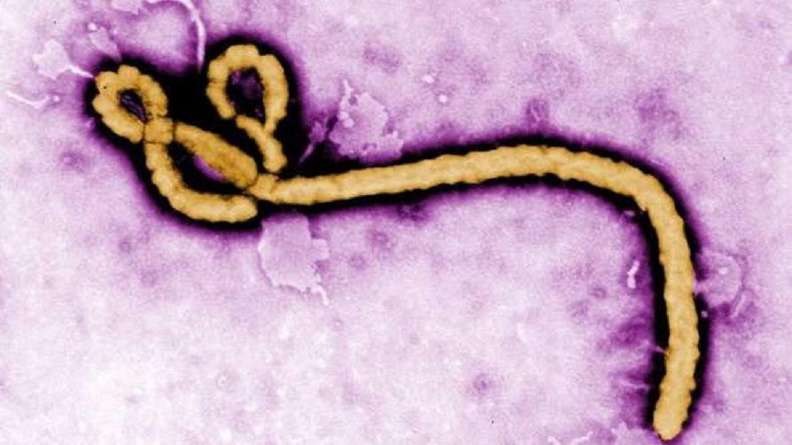 Ebola virus 1