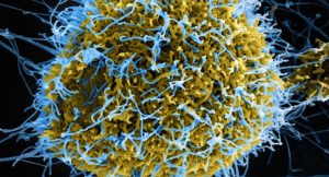 ebola virus